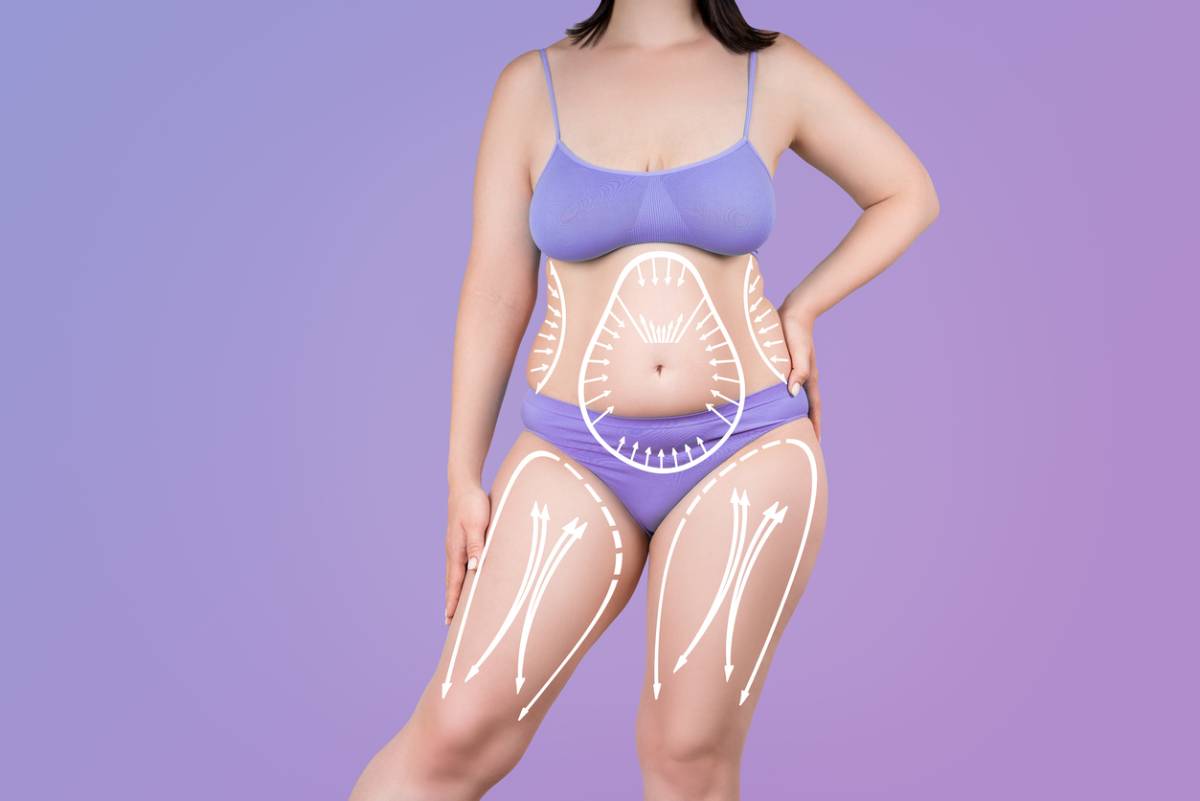 featured image for article on tips for post-pregnancy tummy tuck patients