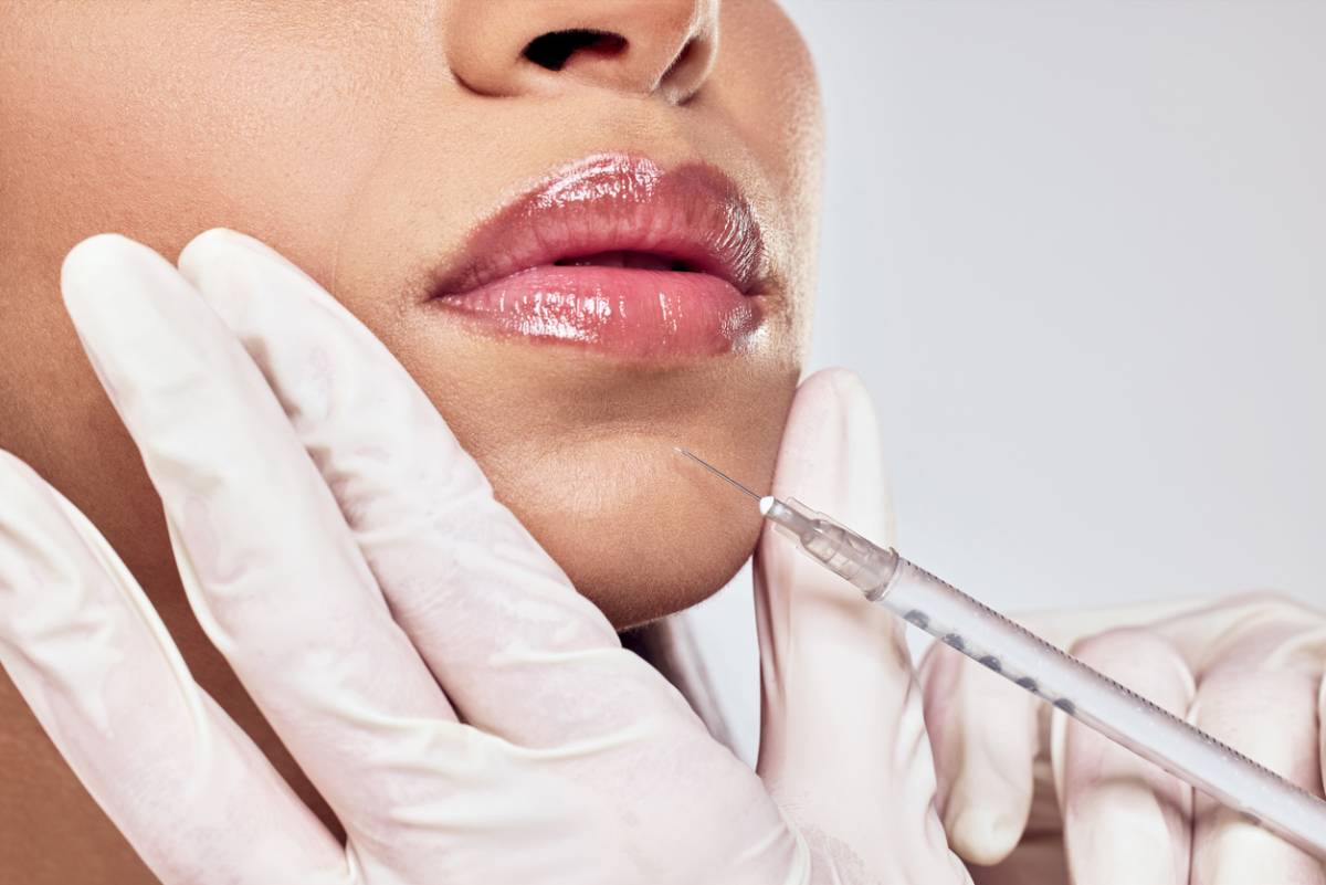 featured image for tips for choosing the right types of dermal fillers