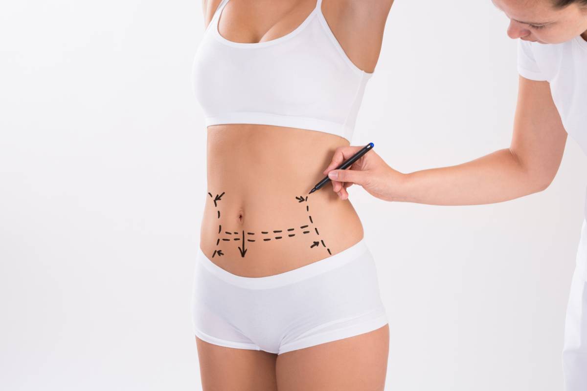 featured image for article on what procedure should you combine with a tummy tuck