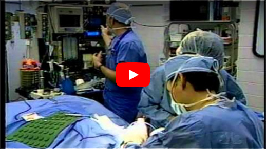 Surgeons skillfully performing surgery in a sterile operating room, showcasing precision and teamwork in a medical procedure.