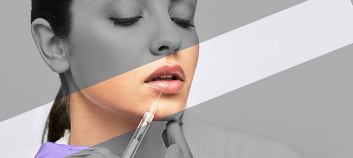 A woman receiving lip enhancement treatment with a needle in a clinical setting, focusing on her lips and the procedure.
