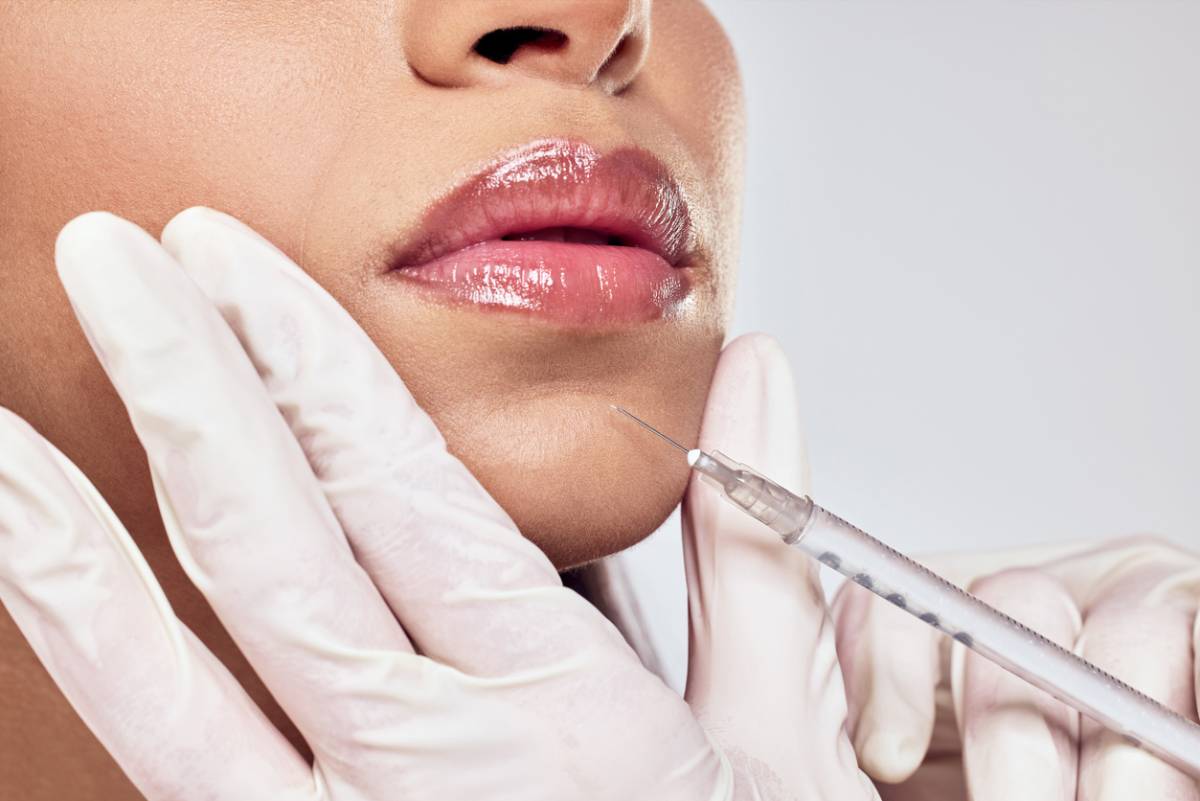 A woman receiving a lip filler injection, showcasing a cosmetic procedure in a clinical setting.